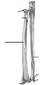 Unlabeled Radius and Ulna Bone Anatomy