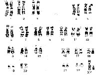 Human Chromosome Karyotype Worksheet Image