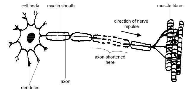 Motor Neuron Diagram Unlabeled Image