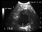 Graft Vascular Ultrasound Worksheet Image